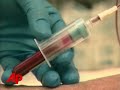 the number of people infected with hiv increases