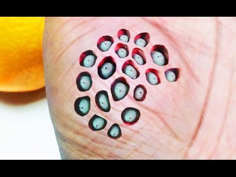 how to cure trypophobia