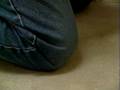Bursitis