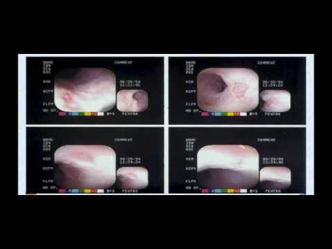 See video