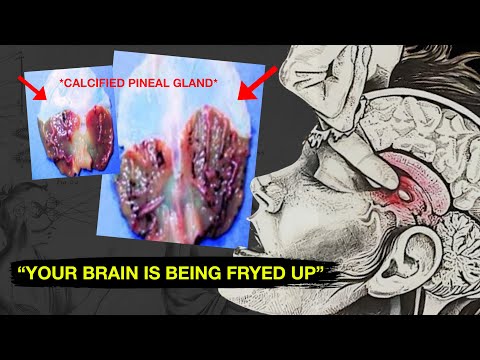 Pineal Gland Importance