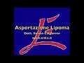 Lipoma