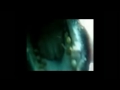 LEAO MARINHO ATACA - ATTACK SEA LION