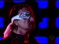 U2