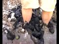 addidas nrtns and white socks in magroves