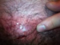 Boil rob
