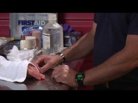 how to treat minor frostbite