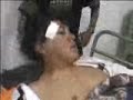Joven Herido 64k