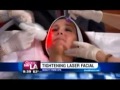 Tightening Laser Facial on Good Day LA