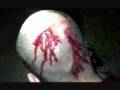 Photo of Zimmerman's Bloody Head...Was His ...