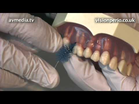 how to control gum disease