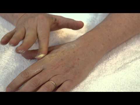 how to perform scar massage