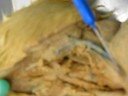 Larynx and trachea