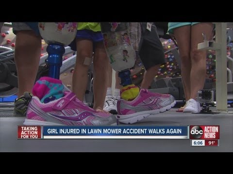 Nugent - Surrounded by friends, family, and plenty of cameras, 2-year-old Ireland Nugent took her first steps with prosthetic legs Monday. The little girl lost both o...