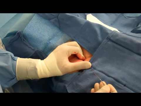how to locate femoral artery