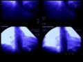Dr. Kuri speaks about Lap-Band® Surgery