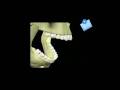 Movimiento mandibular