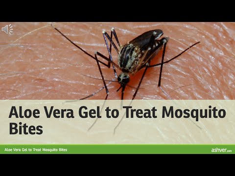 how to treat mosquito bites