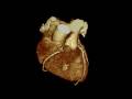videos de Cardiac CT azM Maastricht