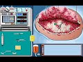 Life and death 2: the brain (subdural hematoma surgery)