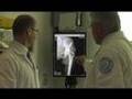What is Osteoarthritis? featuring Dr. Sculco (Dramatic Health)