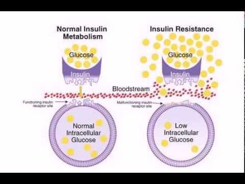 how to cure insulin resistance