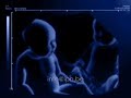 les jumeaux kad et o les jumeaux kad et o