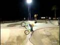 BMX Most painful faceplant.