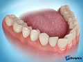Recontouring Teeth to Reduce Crowding