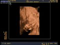 ecografia de nuestro bebe ALICIA Y JESUS!!