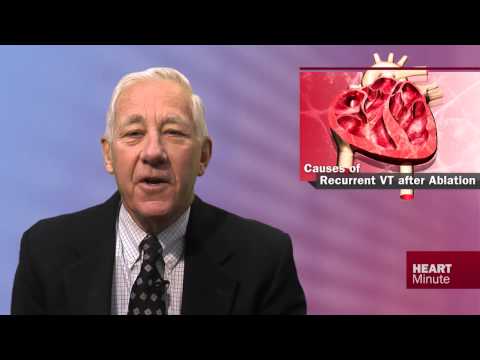 how to perform vt ablation