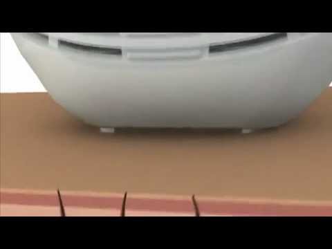 Click aici pentru vizualizare How Remington i-LIGHT Pro Works How Remington i-LIGHT Pro Works