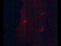 MIDVH + extraverser live at annexet 17/11-07