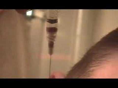 Goodbye Cauliflower Ear