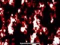 Hatsune Miku ~ Diarrhea ~ [ Traduction En Français + Romaji Karaoké ]