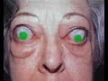 dare 2 eye ball me