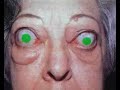 dare 2 eye ball me