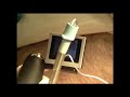 McGrath Video Laryngoscope - Clip 2 McGrath Video Laryngoscope - Clip 2