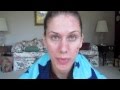 Acne Update! + RANT. Skincare Journal + Does Dairy Cause Acne + High Glycemic Foods