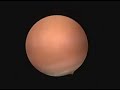 diagnostic-hysteroscopy.html