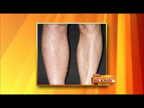 how to eliminate dvt