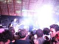 Carga Cerrada- Sindromenecromorbidoaudiovisualmenteadquirido