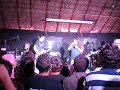 Carga Cerrada- Sindromenecromorbidoaudiovisualmenteadquirido