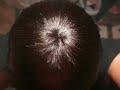 How to make a quick weave cap/how to close quick weave!