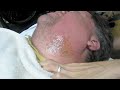How to wax a man's beard from a no double dipping wax salon in Tempe Arizona. Just For You Salon  Spa 480-752-8100