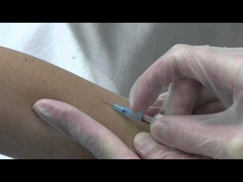 how to perform iv insertion