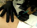 Scarification