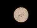 Larva de Par�sito