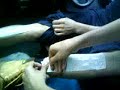 bcl waxing 3 bcl waxing 3