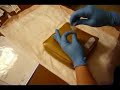 Intramuscular Z-track Injection